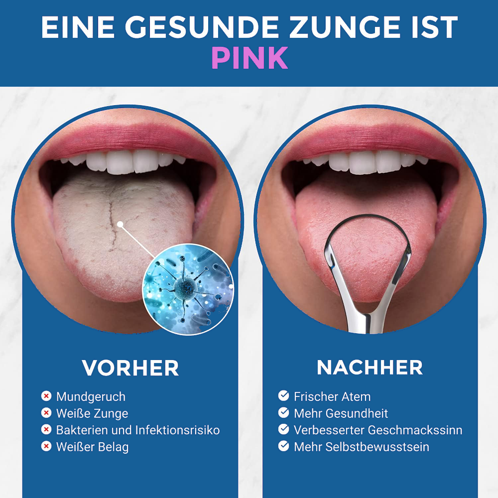 Mundschaber - Der einzige Zungenschaber den man braucht