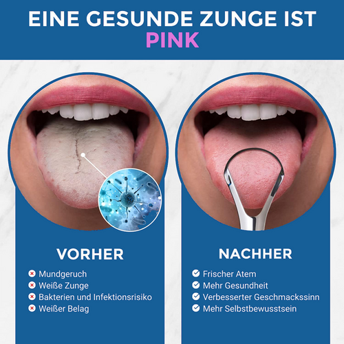 OnlyScrape - Der einzige Zungenschaber den man braucht